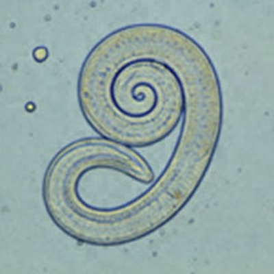 Trichinelle